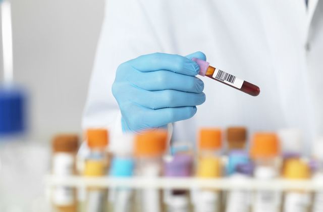test sange detectare cancer